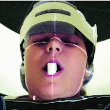 escanograma ou scout.