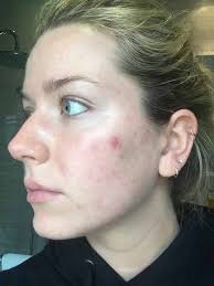 Join facebook to connect with charlotte bouchard and others you may people named charlotte bouchard. Eugenie Bouchard S Sister Was Afraid To Leave House Without Makeup For Two Years Due To Acne Mirror Online