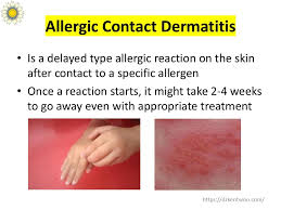 Image result for contact dermatitis