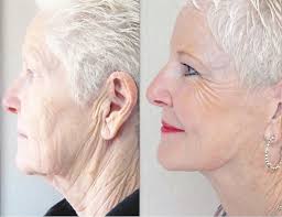 Cardinal facelift nearly complete