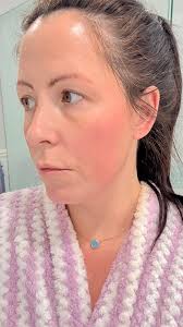 Swelling of you body legs arms , locking joints, changing of your skin  color,color of your uring changes even the number 2 color changes  ,constipation , blurry eyes version, loosing memory ,scratching