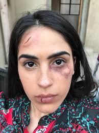 Special Effects/Character Makeup