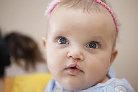 The Finlay Parkinson Cleft Lip & Palate support group