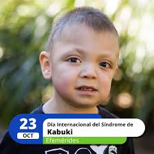 El 23 de octubre se celebra el Día Internacional del Síndrome de Kabuki,  una enfermedad rara que afecta a una de cada 32.000 personas, relacionada  con retrasos en el desarrollo, lento crecimiento