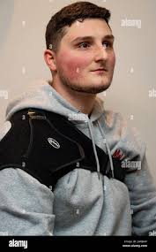 Shoulder after operation hi-res stock photography and images