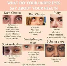 Purple or House? Merlin and I disagree. Covington, LA