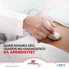 We did not find results for: Quais Exames Sao Usados No Diagnostico Da Apendicite Posts