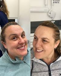 Imogen Johnson (@thedentalsportstherapist) · Instagram photos and videos