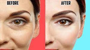 Whoops Best Anti Aging Creams Anti Aging Cream Best Anti Aging