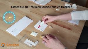 Das geschieht über das blut. Coronavirus Antikorper Test Mit Wenigen Tropfen Blut Sension 29 88