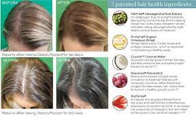 Nutrafol contains the ashwagandha in combination with other ingredients that work together to support healthy hair growth. Amazon Com Deeplyrooted Hair Thinning Supplement Hair Health Nutraceutical Promotes Hair Growth Biotin Ashwagandha Saw Palmetto Beauty