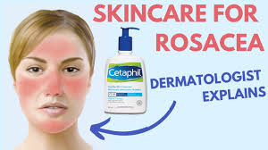 How to choose the best cleanser for rosacea. Rosacea Skin Care Dermatologist Review Youtube