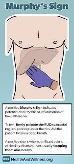 Advanced Physical Exam Maneuvers In 2020 Nursing Information Nursing Notes Nurse Practitioner Student