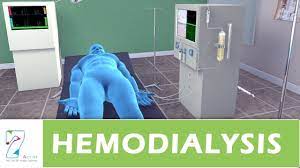 Solute and fluid exchange occurs by diffusion or. Hemodialysis Youtube