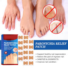Image result for Paronychia feet