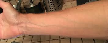 Image result for veins of the arm
