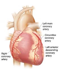 16+ amazing high blood pressure diet ideas. Understanding Coronary Artery Disease Cad Saint Luke S Health System