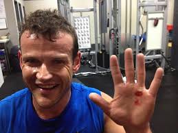 Got a rip? Care and conditioning for your hands when weightlifting or  kipping