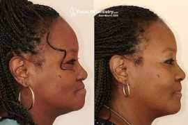 Renetta Rue's Instagram, Twitter & Facebook