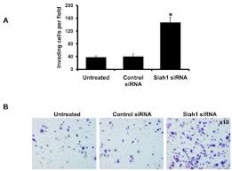 A cbc tells your cancer care team about the cells in your blood. Siah1 Proteins Enhance Radiosensitivity Of Human Breast Cancer Cells Bmc Cancer Full Text