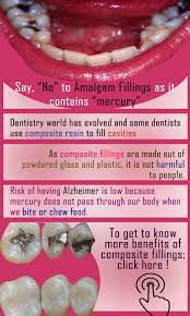 Fillings Are Materials That Are Placed Into The Tooth After Decay Has Been Removed To Seal Off The Area And Keep The Decay Fro Dental Fillings Dental Dentistry