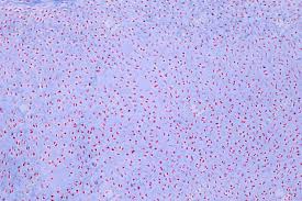Use the illustrations in your textbook as a guide and identify with the scanning objective the following structures. Cross Section Human Cartilage Bone Under Microscope View For Stock Photo Picture And Royalty Free Image Image 100869314