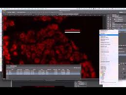 Setting Scales And Making Scale Bars For Microscopy Images Youtube