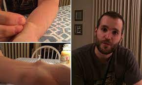 The book method (17 ) frankincense oil (15 ) binding pressure method (7 ) load more. Video Shows Man Popping A Large Ganglion Cyst On His Arm With A Pin Daily Mail Online