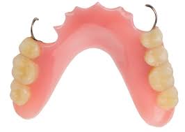 In general, removable partial dentures opposing natural teeth will require greater support and stabilization over time because of the greater functional load demands. 9 Tips Tricks For Removable Partial Dentures With Dr Manny Vasant Reena Wadia