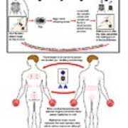 Image result for Sarcoptes scabiei life cycle