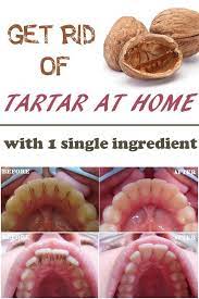 Tomato, strawberries, gooseberries and etc are a rich source of vitamin c. Get Rid Of The Tartar With A Single Ingredient At Home Beauty Tricks Hollistic Health Health Remedies Natural Remedies