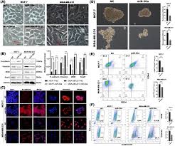 Breast biopsy markers are placed during a breast biopsy procedure to identify the area where breast tissue was removed. Mir 30a Sox4 Double Negative Feedback Loop Is Modulated By Disulfiram And Regulates Emt And Stem Cell Like Properties In Breast Cancer