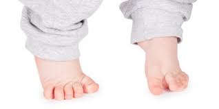 Welche entwicklungsschritte dein kind durchläuft, bis es alleine neben dir her gehen kann, findest du hier. Zehenspitzengang Wenn Das Kind Nur Auf Den Zehenspitzen Lauft