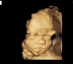 Evie Savitzky (@itsabalancedlife) • Instagram photos and videos