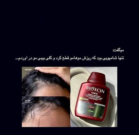 ❤️ شامپو فورت بیوکسین❤️ بعد از مصرف ۷ هفته ریزش موهاتون قطع میشه🤌🏼 تار  موهاتون زخیم‌ میشه و کلی بیبی مو دارید😍 بها‌ء محصول : ۲۹۰ 😳 #شامپو #شامپو_بیوکسین#بیوکسین#شامپو_بدون_سولفات#شامپو_ضدریزش