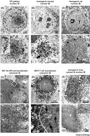 Maybe you would like to learn more about one of these? Investigating The Structure Of Neurotoxic Protein Aggregates Inside Cells Trends In Cell Biology