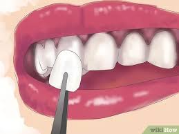 Maybe you would like to learn more about one of these? 5 Ways To Fix Crooked Teeth Wikihow