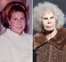 Plastic surgery might not only help make people look younger or more attractive. Pin On No Just No