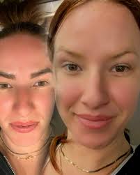 Enfuse Medical Spa™ (@enfusemedicalspa) · Instagram 照片和视频