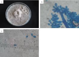 Image result for Botrytis cinerea