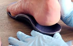 Une douleur face interne du talon appelée tendinite du muscle tibial postérieur. Metatarsalgie Les Cliniques Podimedic Clinique Podiatrique