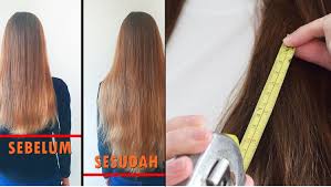Maybe you would like to learn more about one of these? 11 Cara Memanjangkan Rambut Dengan Sampo Hingga Bahan Alami Seminggu Bisa Tumbuh 30 Senti