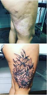 Lo más común es intentar tapar cicatrices de cesárea, operaciones, accidentes, etc. Tatuajes Para Tapar Cicatrices Ideas Y Disenos Modaellas Com