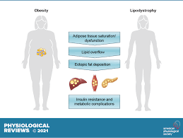 Image result for Lipodystrophy