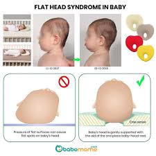 The Head Dented Why Please Watch The Video To Know How To Treat The Baby These Are The Mistakes That Most Parent Baby Pillows Flat Head Baby Baby Life Hacks