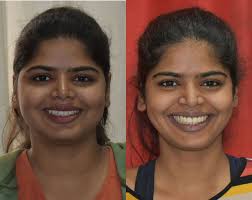 Dentists in Jagathy, Thiruvananthapuram