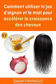 Comment Utiliser Le Jus D Oignon Et Le Miel Pour Accelerer La Croissance Des Cheveux Croissance Des Cheveux Jus D Oignon Cheveux