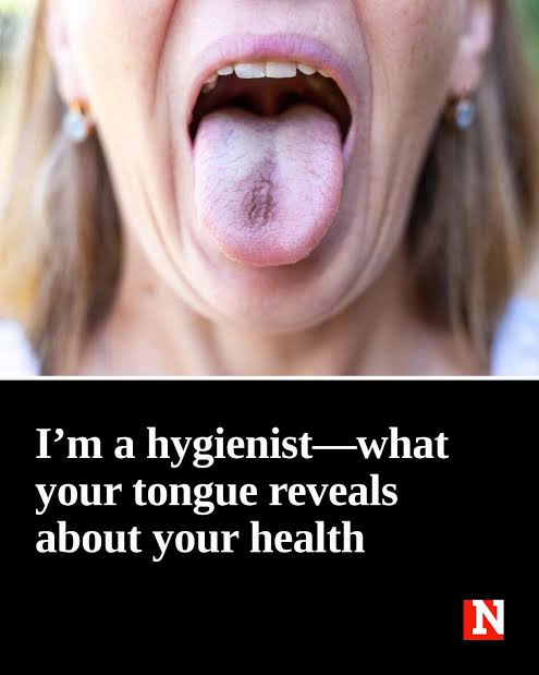 Your tongue may reveal more than you think 😲