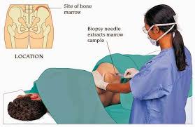 Image result for Bone Marrow Exam