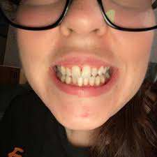 TOP 10 BEST Affordable Dentist near Walla Walla, WA